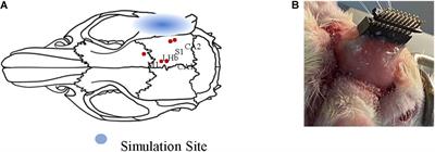 Neuromodulation Effect of Very Low Intensity Transcranial Ultrasound Stimulation on Multiple Nuclei in Rat Brain